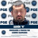 FGE logra vinculación a proceso contra hombre por el delito de lesiones calificadas en Tijuana